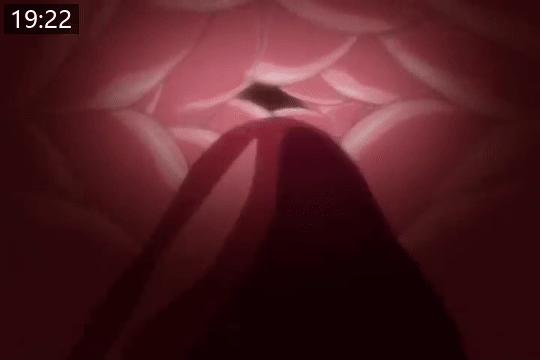 45b6f74ffd908.gif.webp